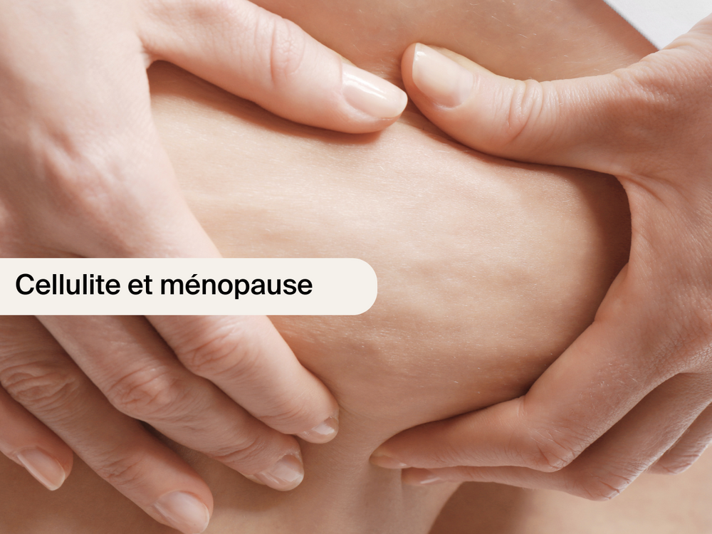 Cellulite et ménopause