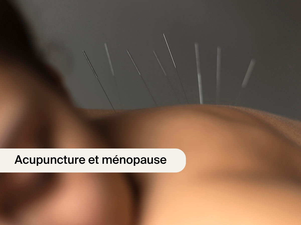 Acupuncture et ménopause